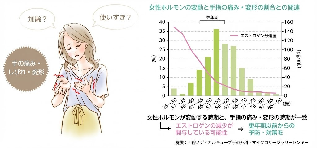 女性ホルモンが大きく変動する時期には関節の不調が増えます。とくに更年期障害の時期、妊娠中、産後・授乳中などはエストロゲンが急に変化するため、手指のこわばりや関節痛、腱鞘炎のような症状が出やすくなります。