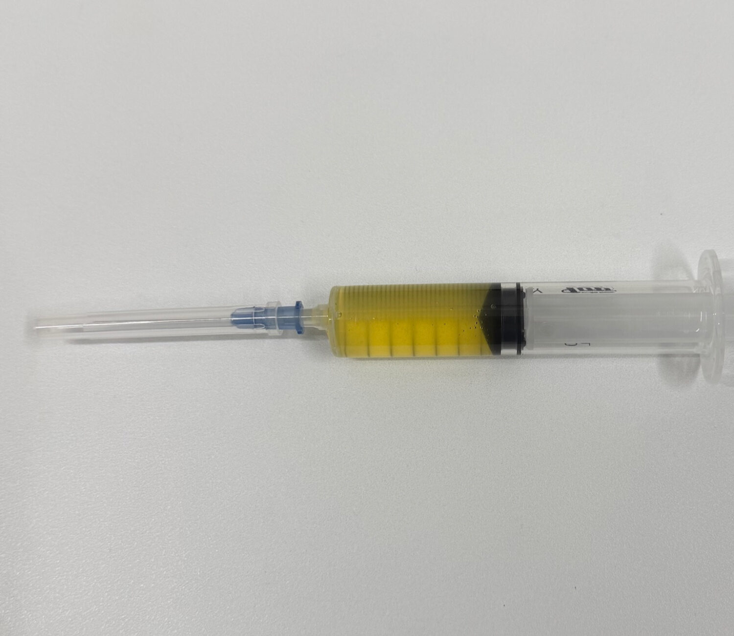 ベーカー嚢胞は、膝の裏(膝窩)にできる袋状の腫れ(嚢胞)で、中には関節液(滑液)がたまっています。必要に応じて、吸引・注射や原因疾患の治療を行うことで、腫れや痛みの改善を図ります。